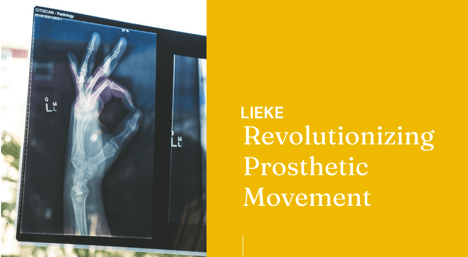 PhD+ 2024 demo: predictive prosthetic control aiming for near-zero latency